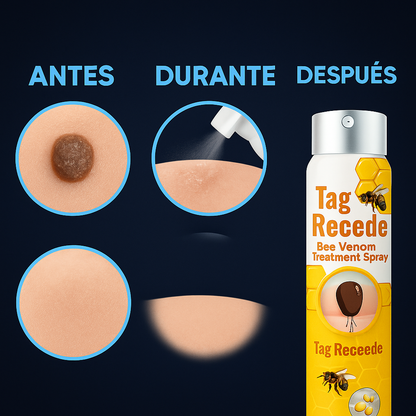 Spray Adiós Verrugas