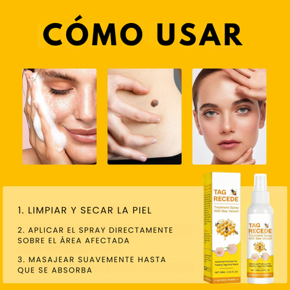 Spray Elimina Verrugas- Veneno De Abeja