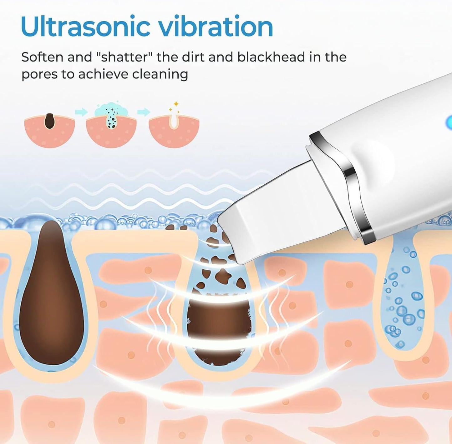 Limpiador Facial Ultrasónico Pro