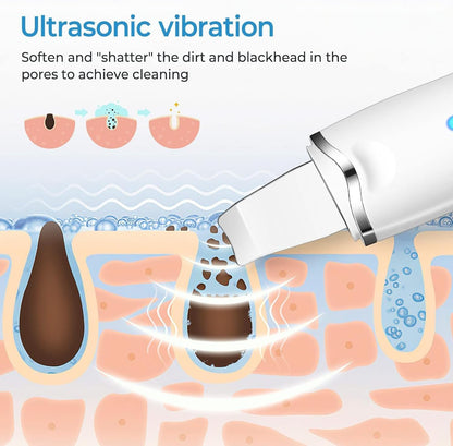 Limpiador Facial Ultrasónico Pro