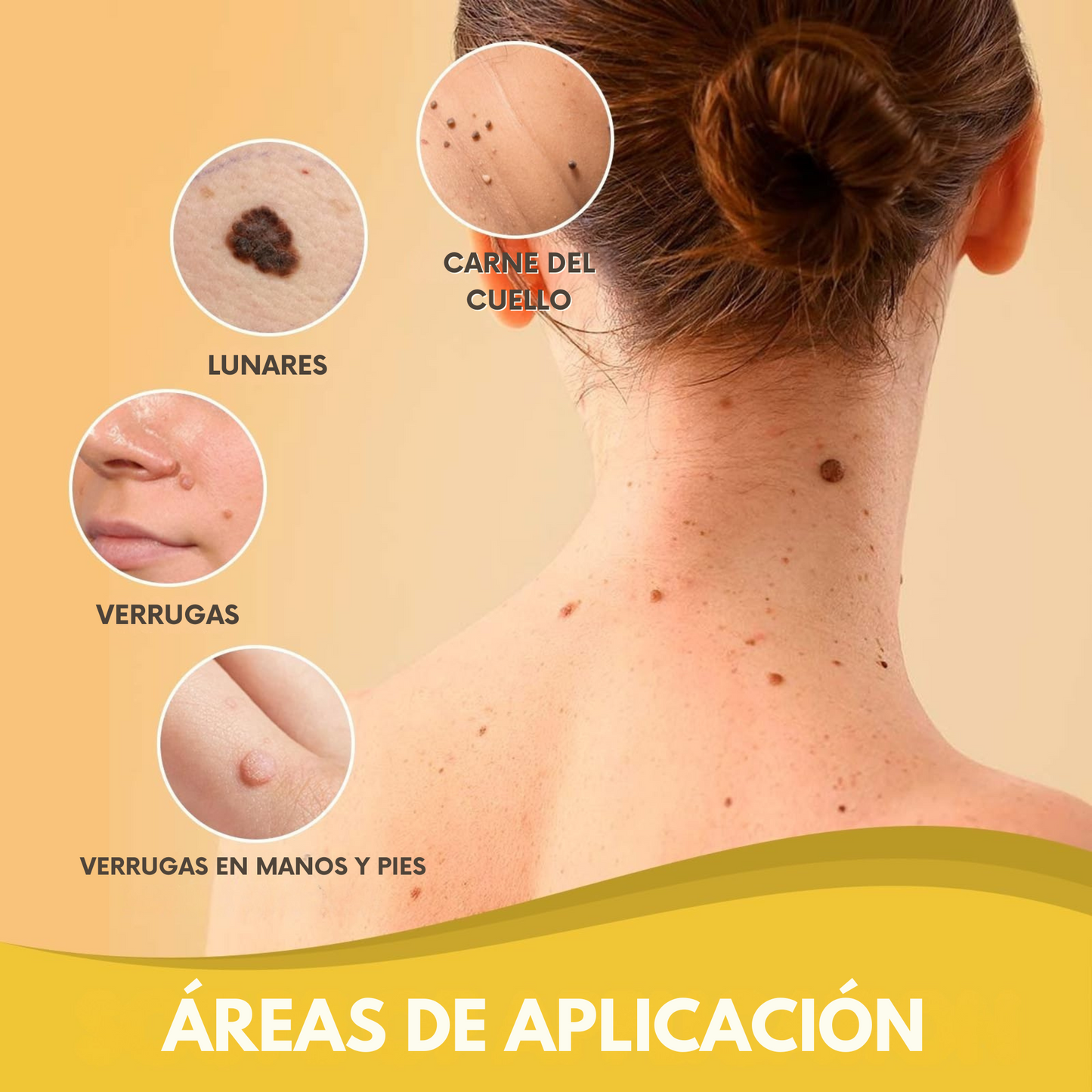Spray Elimina Verrugas- Veneno De Abeja