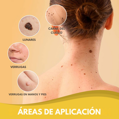 Spray Elimina Verrugas- Veneno De Abeja