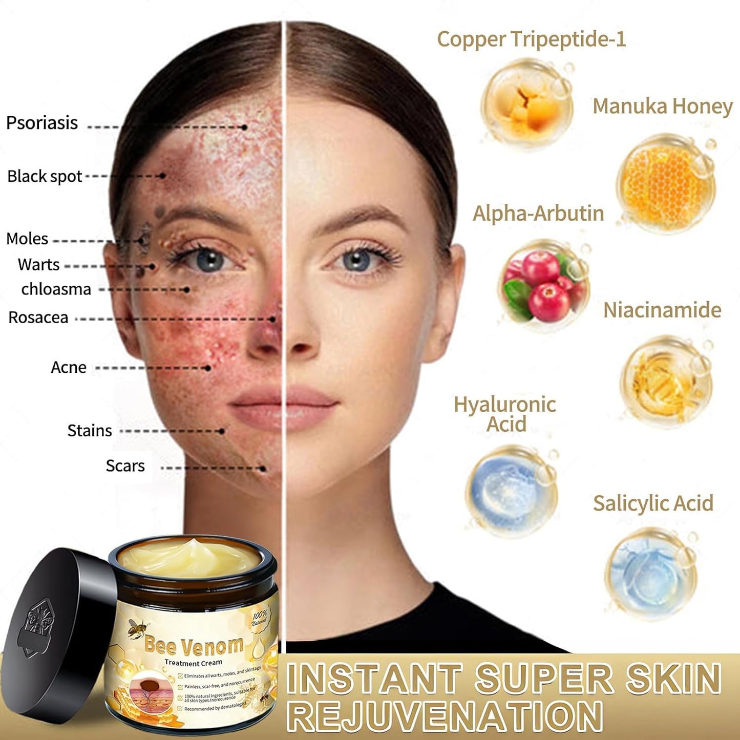 Crema Veneno de Abeja Pro