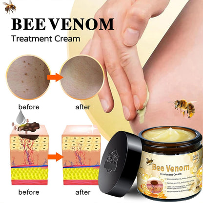 Crema Veneno de Abeja Pro
