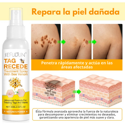 Spray Elimina Verrugas- Veneno De Abeja